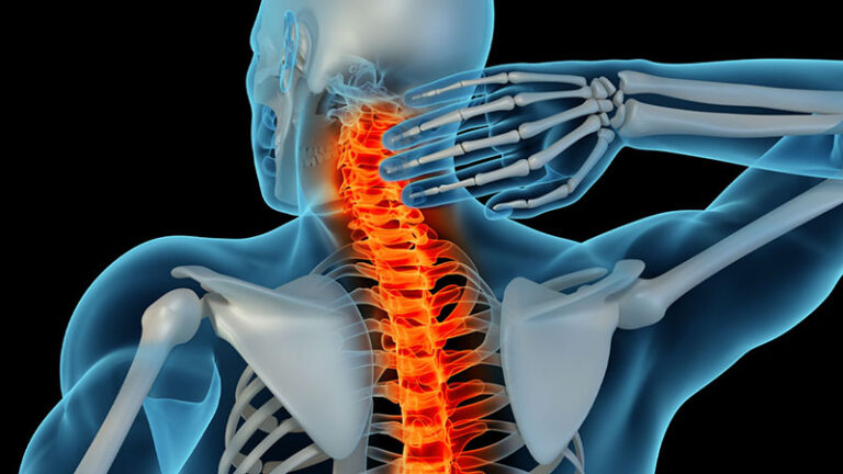 Spinal Cord Injury: Signs, Causes, and Prevention