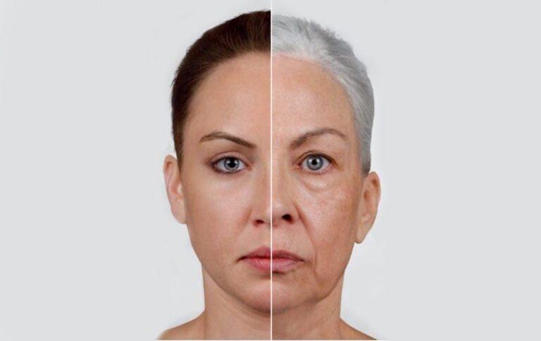 Why your face ages and what you can do