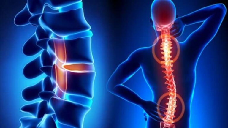 Understanding Spinal Cord Injuries: Causes, Symptoms, and Treatment